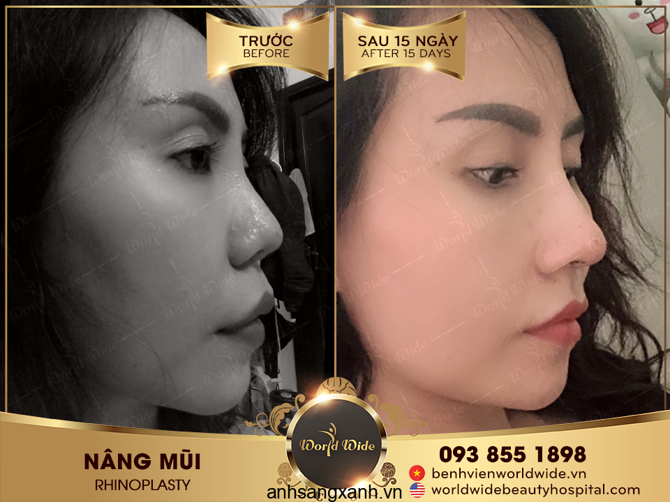 Cách chọn mắt kính cho người mũi thấp che ngay khuyết điểm 2