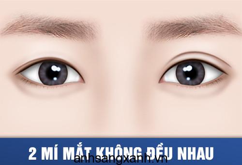 Cắt kính mắt không độ giá bao nhiêu tiền? Ở đâu? 2