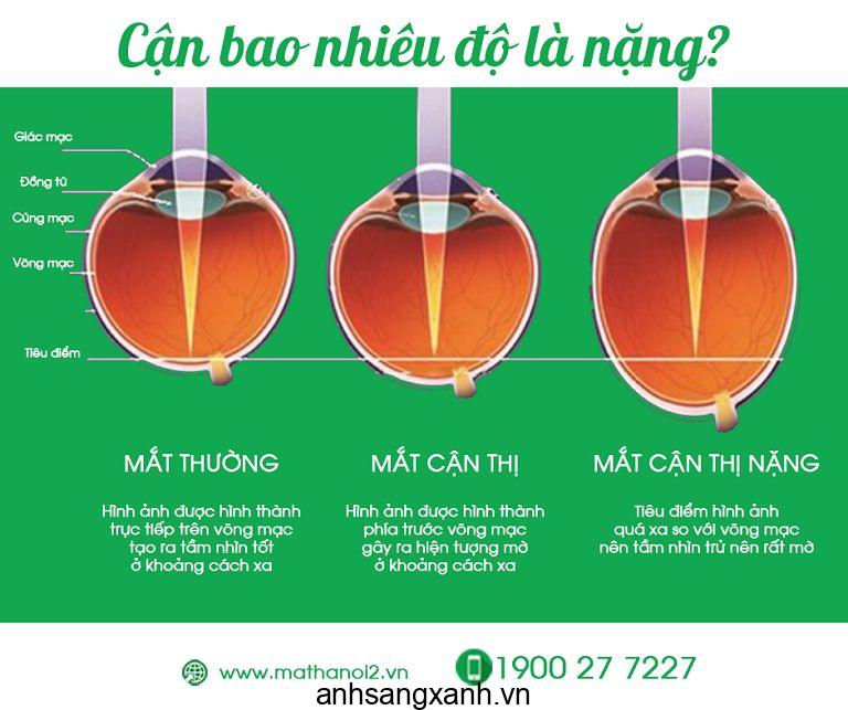 Kính mắt không độ là gì? Không bị cận có nên đeo kính không? 4